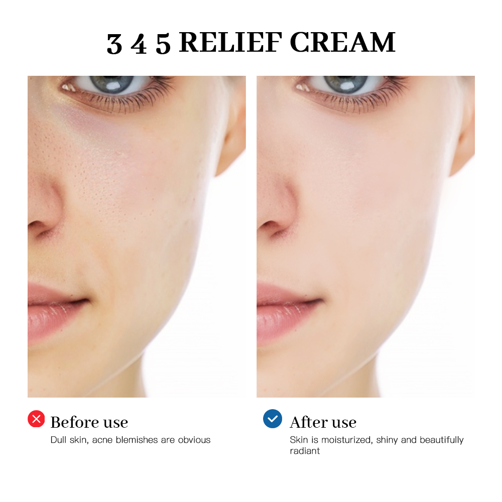 345 Linderungscreme, umfassend – Healing Wellness Bewertung und Preis